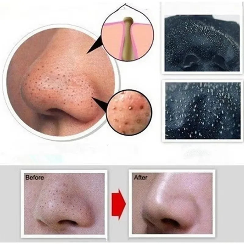 Blackhead Remover Nose Face Mask -  Glowcella
