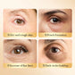 Collagen Gel Dark Circles Remover Eye Patches -  Glowcella