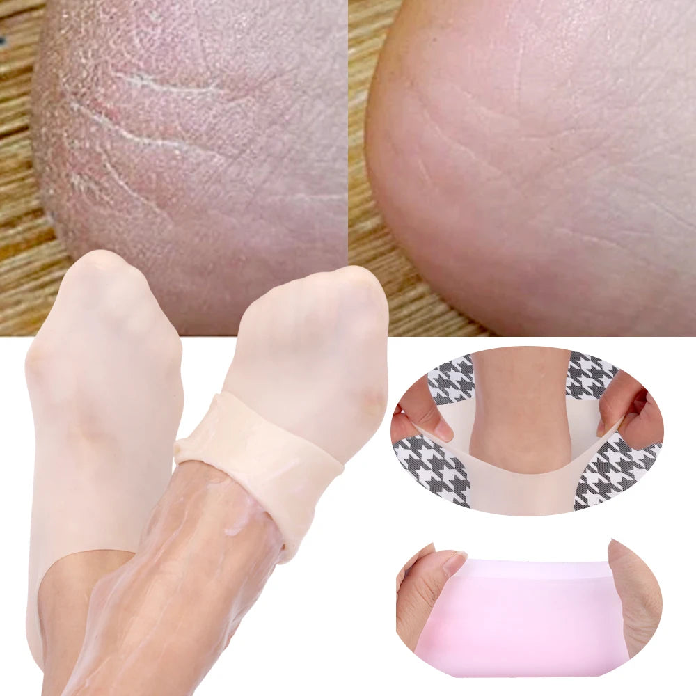 Silicone Moisturizing Foot Socks -  Glowcella